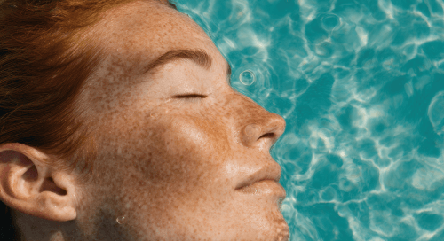 Primo piano del viso di una donna lentigginosa che galleggia in acqua con gli occhi chiusi, immagine evocativa dei segni lasciati dal sole sulla pelle e dell’importanza di trattare le discromie cutanee.